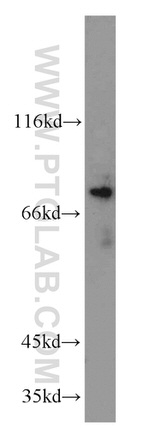 DNAJC10 Antibody in Western Blot (WB)