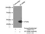 ACADSB Antibody in Immunoprecipitation (IP)