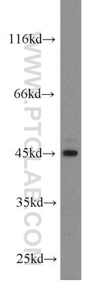 ACADSB Antibody in Western Blot (WB)