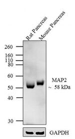 MAP2 Antibody in Western Blot (WB)