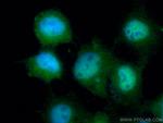 SIRT1 Antibody in Immunocytochemistry (ICC/IF)