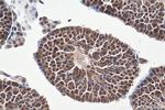 DNAJB1 Antibody in Immunohistochemistry (Paraffin) (IHC (P))