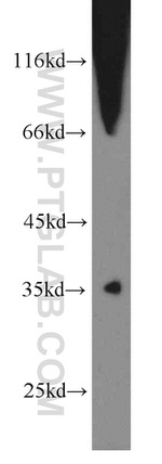 SNX20 Antibody in Western Blot (WB)