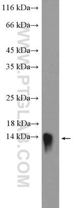 SAA2 Antibody in Western Blot (WB)