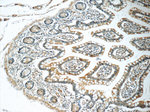 WFDC1 Antibody in Immunohistochemistry (Paraffin) (IHC (P))