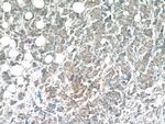 WFDC1 Antibody in Immunohistochemistry (Paraffin) (IHC (P))