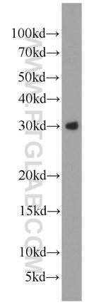 WFDC1 Antibody in Western Blot (WB)