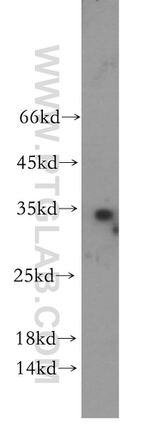 WFDC1 Antibody in Western Blot (WB)