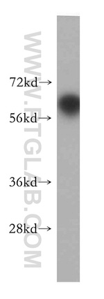 RCBTB2 Antibody in Western Blot (WB)