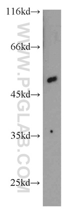 CYP1A1 Antibody in Western Blot (WB)