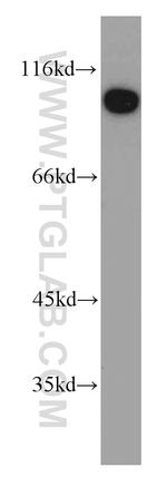 CTAGE1 Antibody in Western Blot (WB)