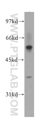 CPEB1 Antibody in Western Blot (WB)