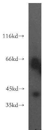 TRAM2 Antibody in Western Blot (WB)