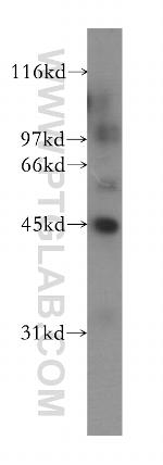 IHH Antibody in Western Blot (WB)