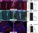 PCNA Antibody in Immunohistochemistry (IHC)