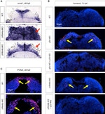 PCNA Antibody in Immunohistochemistry (IHC)