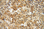 Galectin-4 Antibody in Immunohistochemistry (Paraffin) (IHC (P))