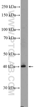 Zinc-alpha-2-glycoprotein Antibody in Western Blot (WB)