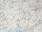 KIF22 Antibody in Immunohistochemistry (Paraffin) (IHC (P))