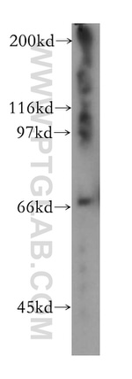 KIF22 Antibody in Western Blot (WB)