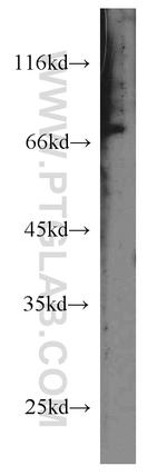 PHACTR4 Antibody in Western Blot (WB)