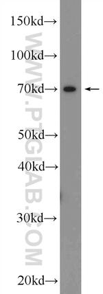 TRPV6 Antibody in Western Blot (WB)