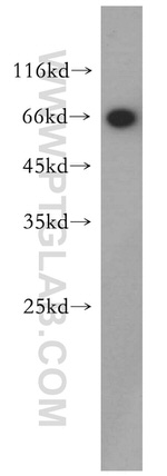 TRPV6 Antibody in Western Blot (WB)