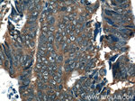 RAB27B Antibody in Immunohistochemistry (Paraffin) (IHC (P))