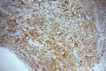 RAB27B Antibody in Immunohistochemistry (Paraffin) (IHC (P))