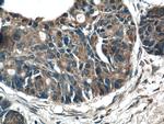 RAB27B Antibody in Immunohistochemistry (Paraffin) (IHC (P))