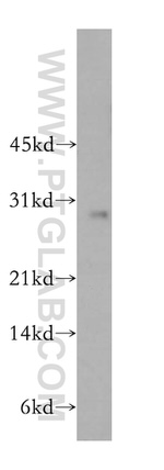 RAB27B Antibody in Western Blot (WB)