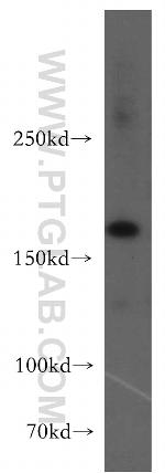 UGCGL2 Antibody in Western Blot (WB)