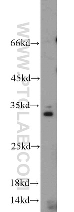 Caspase 8 Antibody in Western Blot (WB)