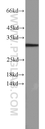 Caspase 8 Antibody in Western Blot (WB)