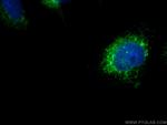 SDCCAG8 Antibody in Immunocytochemistry (ICC/IF)