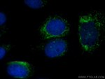 SDCCAG8 Antibody in Immunocytochemistry (ICC/IF)