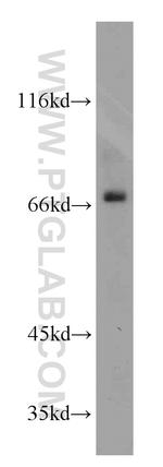 SDCCAG8 Antibody in Western Blot (WB)