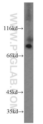 SDCCAG8 Antibody in Western Blot (WB)