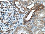 SYVN1 Antibody in Immunohistochemistry (Paraffin) (IHC (P))