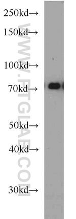 SYVN1 Antibody in Western Blot (WB)