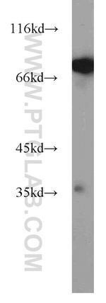 SYVN1 Antibody in Western Blot (WB)