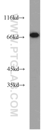 SYVN1 Antibody in Western Blot (WB)