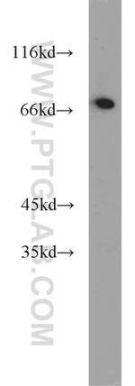 SYVN1 Antibody in Western Blot (WB)