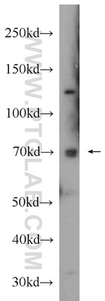 SYVN1 Antibody in Western Blot (WB)