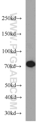 SYVN1 Antibody in Western Blot (WB)