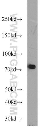 SYVN1 Antibody in Western Blot (WB)