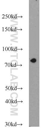 SYVN1 Antibody in Western Blot (WB)