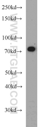 SYVN1 Antibody in Western Blot (WB)