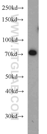 SYVN1 Antibody in Western Blot (WB)