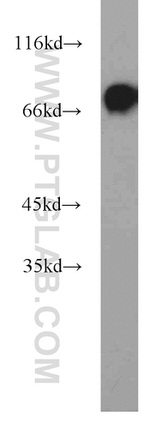 SYVN1 Antibody in Western Blot (WB)